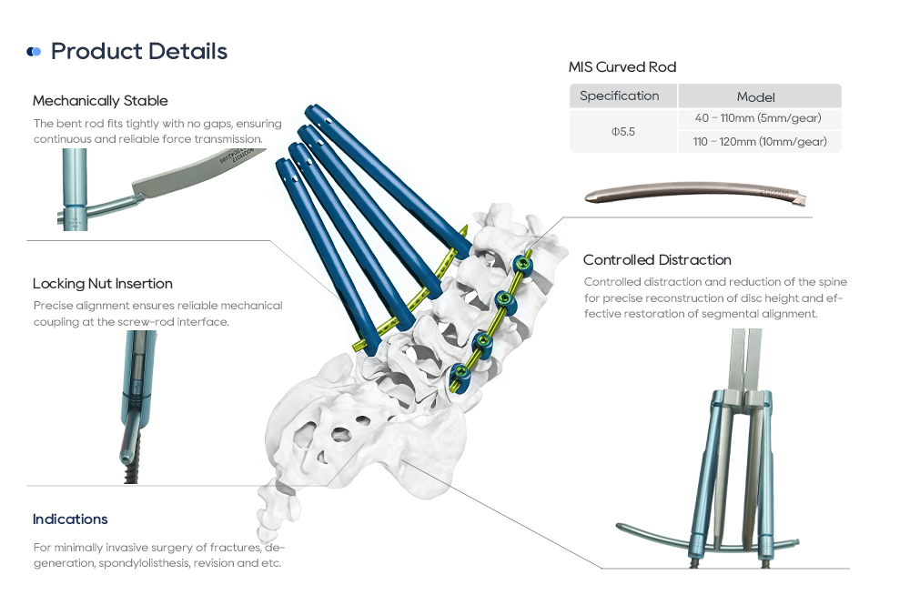 MisFix 5.5 Components: Coaxial Pedicle Screw, Polyaxial Screw, Curved Rod, and Locking Nut Componentes MisFix 5.5: tornillo pedicular coaxial, tornillo poliaxial, varilla curva y tuerca de bloqueo