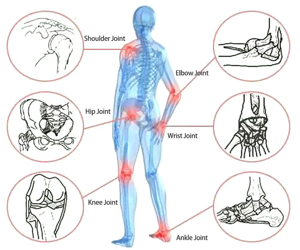 Implantes de medicina deportiva y soluciones artroscópicas para cirugía ortopédica