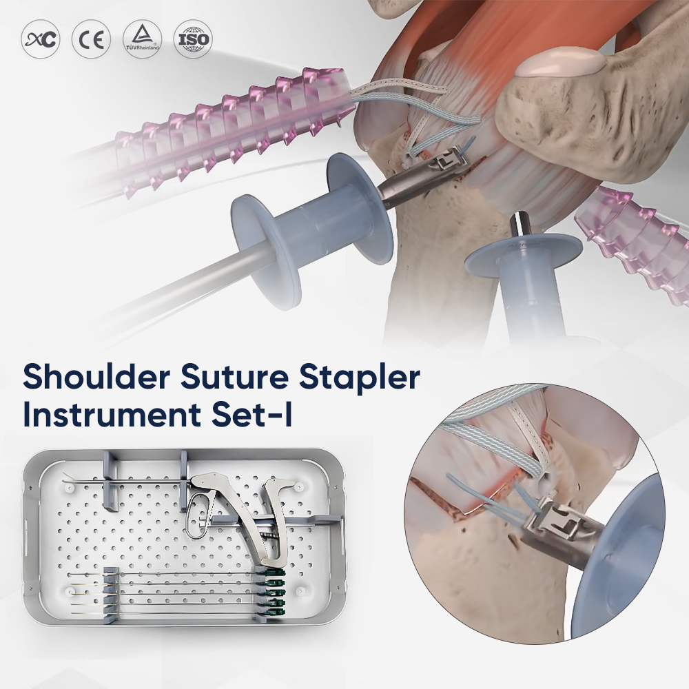 1 Pasador de sutura artroscópica | Juego de grapadoras para sutura de hombro y rodilla | Pasador de sutura artroscópica para reparación del manguito rotador