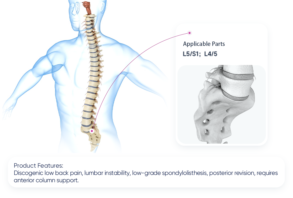 3 Sistema de jaula Implante de fusión intersomática lumbar anterior | XC Medico ALIF |
