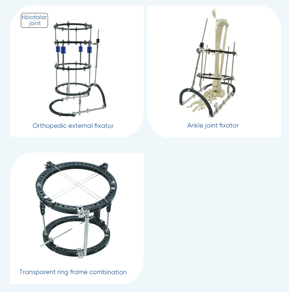 Fijador externo de pelvis y tobillos - Compre producto en XC Medico Fijador externo 