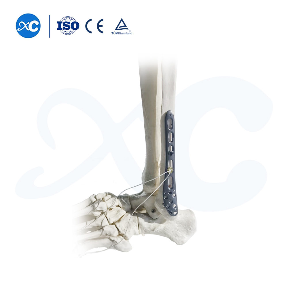 Placa de bloqueo tibioperoneo distal-III