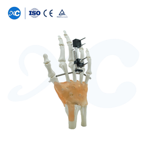 Fijación Externa Para Metacarpianos Y Falanges