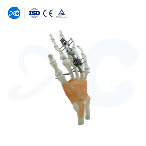 Mini Sistema de Fijación Externa para Metacarpianos y Falanges