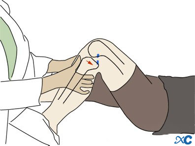 Articulación de la rodilla