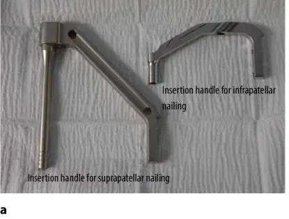 Fracturas de tibia, t&eacute;cnica de clavo intramedular suprapatelar-16