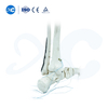 Placa de bloqueo tibioperoneo distal-III