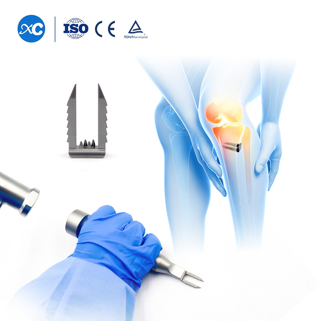 Sistema de grapas para fijación de ligamentos: reconstrucción del LCA