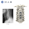 Sistema de placa cervical anterior-I | Implante de columna de titanio de perfil bajo