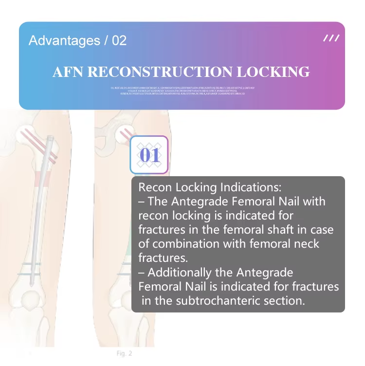 Clavo intramedular para reconstrucci&oacute;n femoral-3