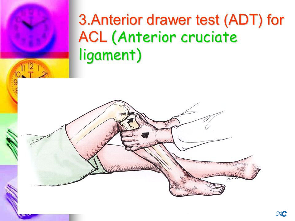 Articulaci&oacute;n de rodilla-13