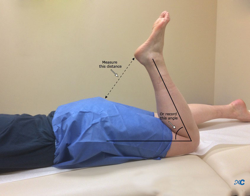 Articulaci&oacute;n de rodilla-4