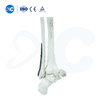 Placa de bloqueo para tibioperoneo distal-I