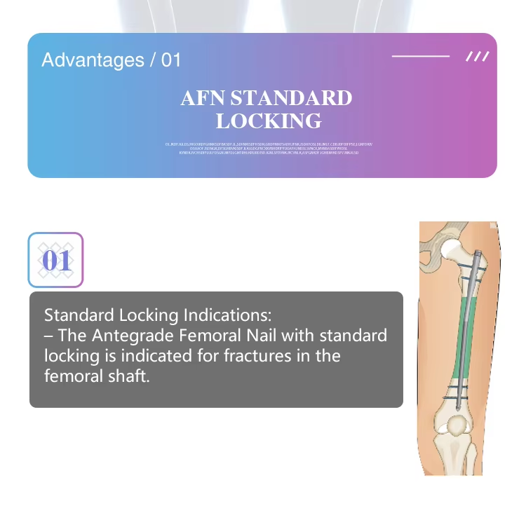 Clavo intramedular para reconstrucci&oacute;n femoral-2