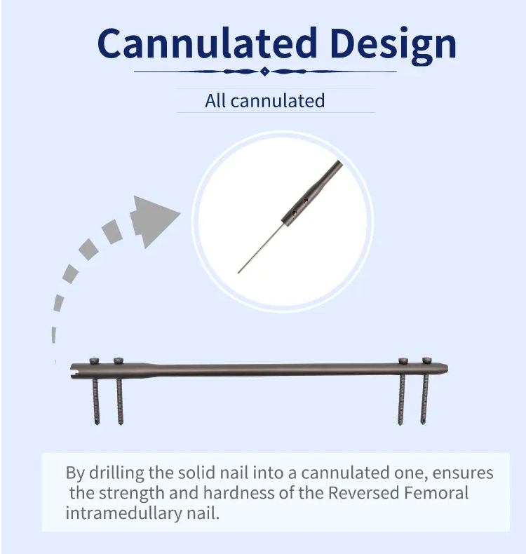 Clavo intramedular femoral invertido-4