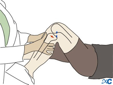 Articulaci&oacute;n de rodilla-6