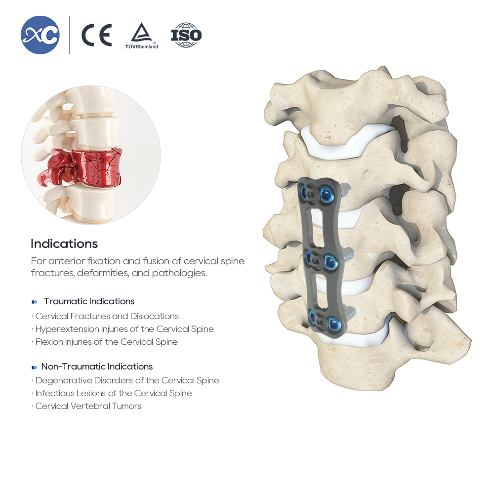 Sistema de placa cervical anterior-I | Implante de columna de titanio de perfil bajo