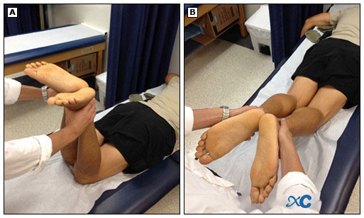 Articulaci&oacute;n de rodilla-8