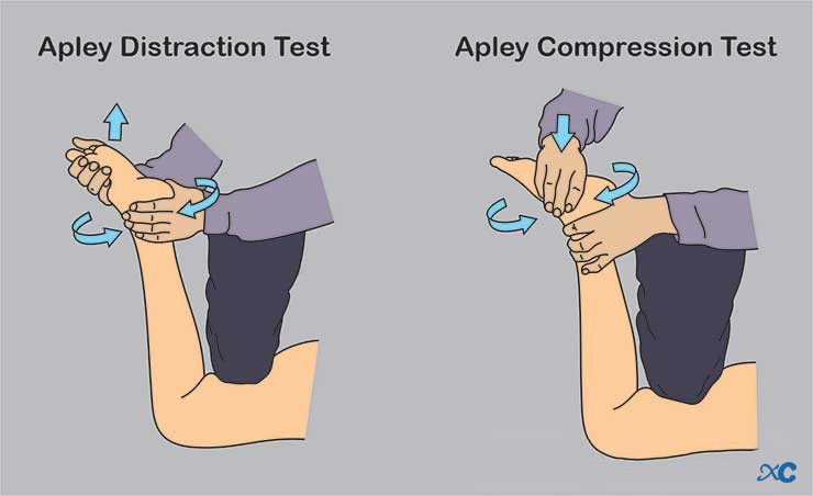Articulaci&oacute;n de rodilla-15