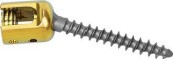 Tornillo pedicular il&iacute;aco 6.0