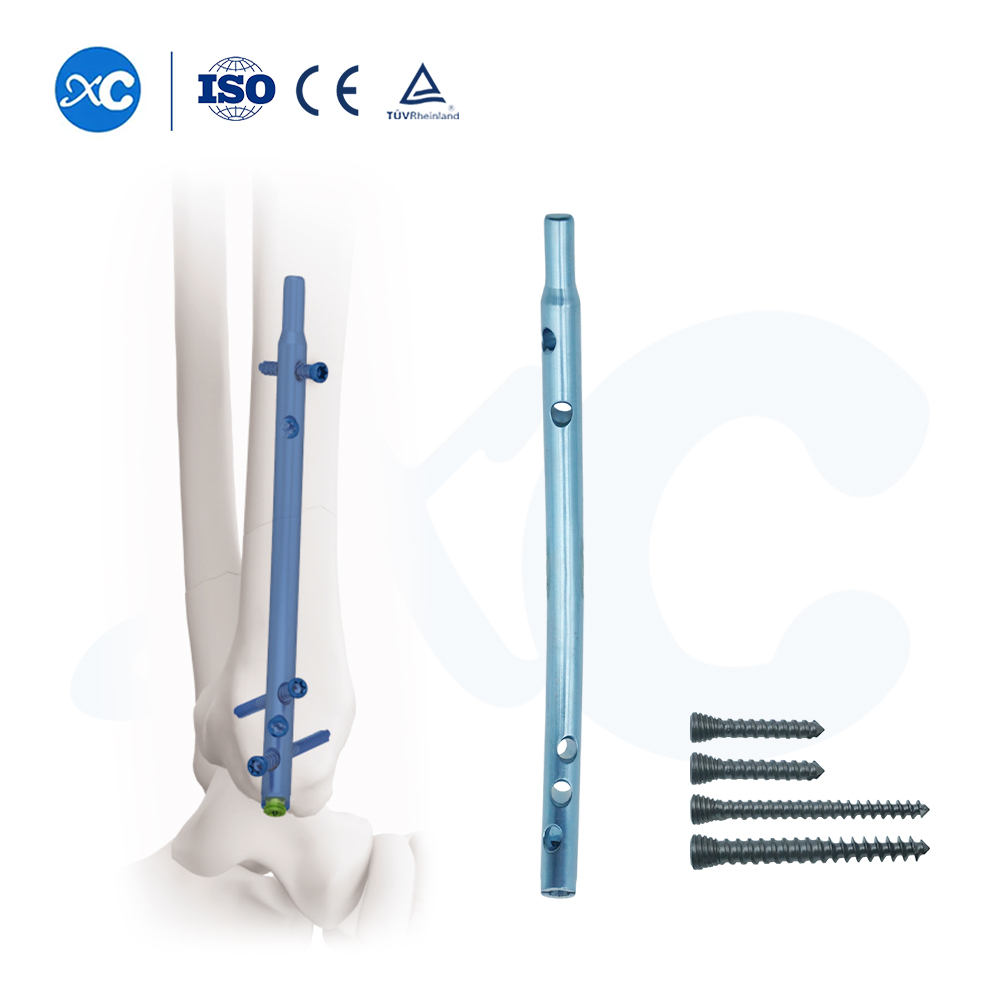 Clavo intramedular tibial distal: fijación retrógrada