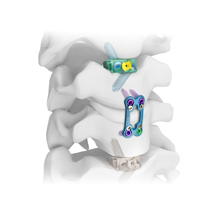Sistema de placa cervical anterior