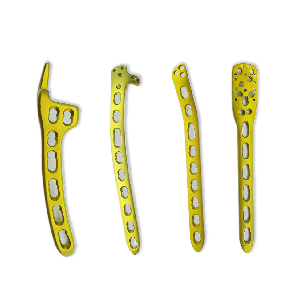 Trauma locking plates