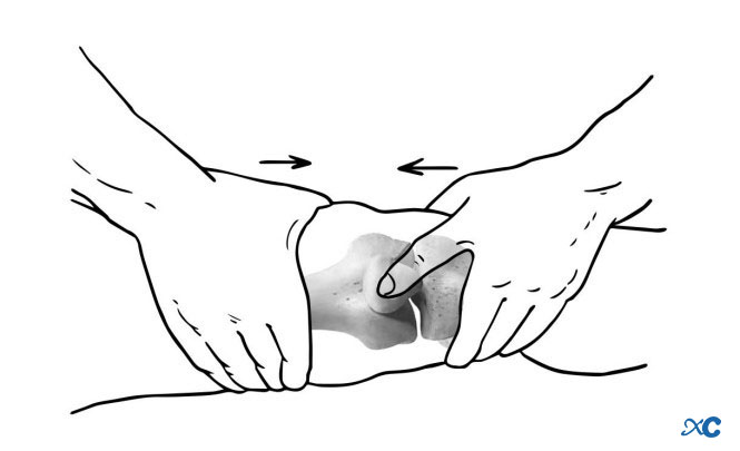 Articulaci&oacute;n de rodilla-12