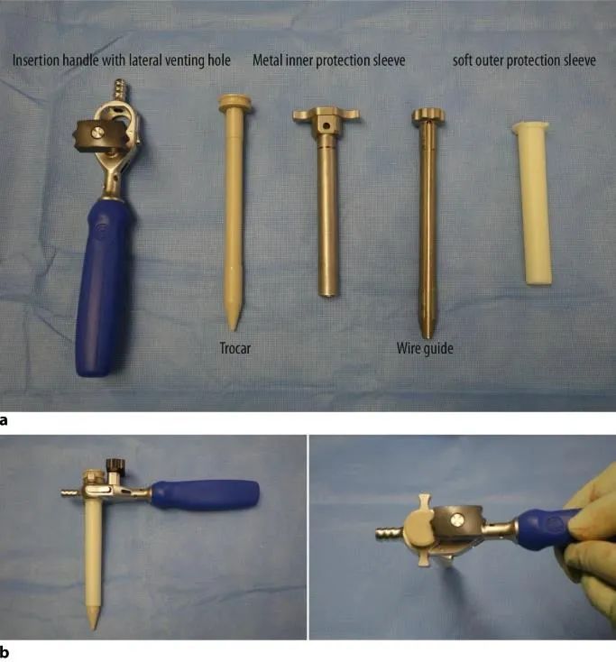 Fracturas de tibia, t&eacute;cnica de clavo intramedular suprapatelar-6