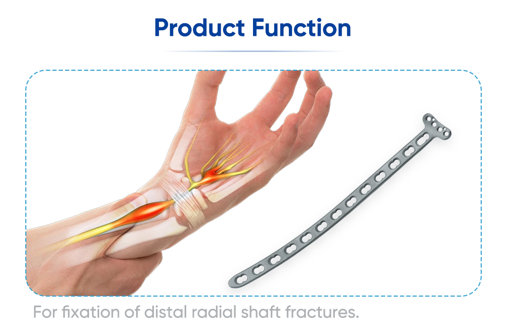 Placa de bloqueo dorsal para fijaci&oacute;n del radio distal y compatibilidad con tornillos