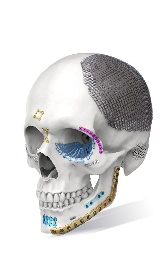 CMF/Sistema Maxilofacial