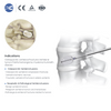 Sistema de cifoplastia (PKP/PVP): kit de cemento y globo para el cuerpo vertebral