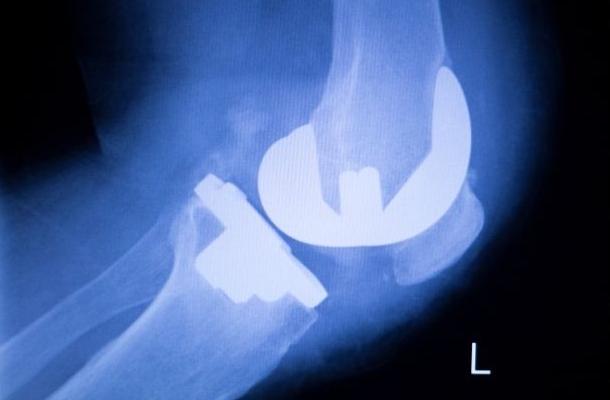 Articulaciones de cadera y rodilla-1