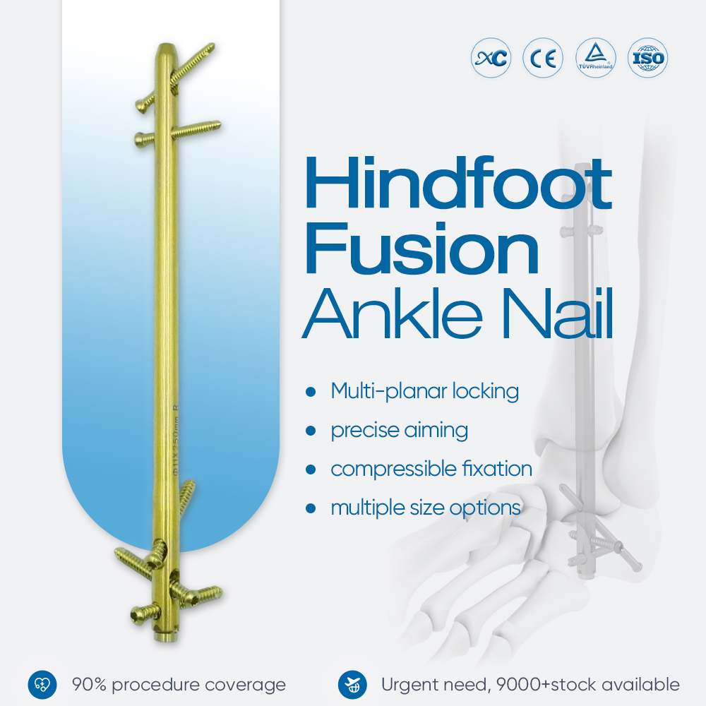 Sistema de clavos de tobillo Hindfoot Fusion para fijaci&oacute;n de artrodesis de tobillo