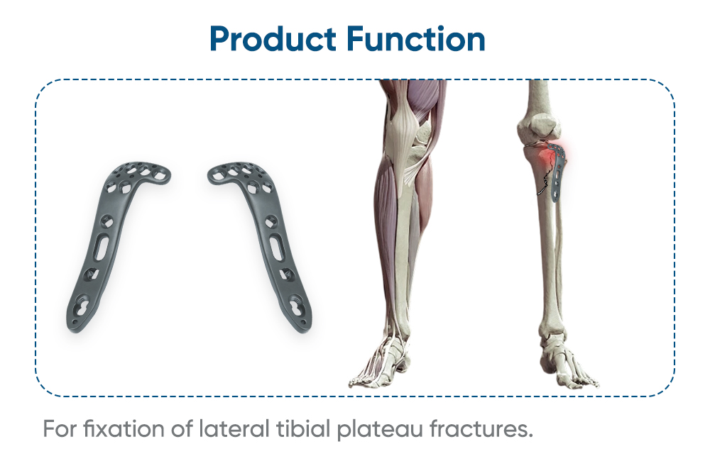 Placa de bloqueo poliaxial lateral para meseta tibial - Compre producto en XC Medico 