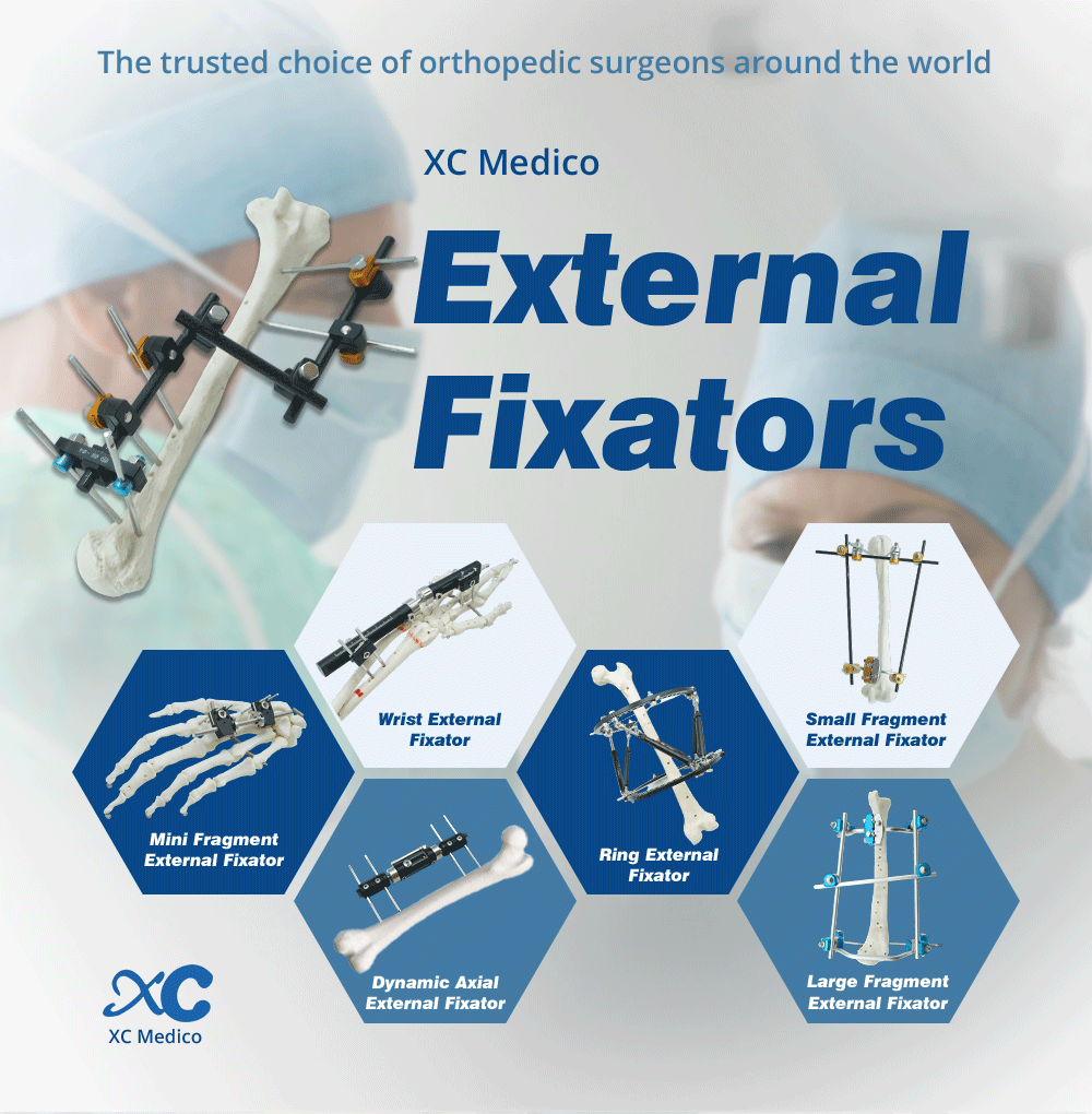 Fijadores externos de miembro superior para fracturas de brazo, antebrazo, codo y mu&ntilde;eca.