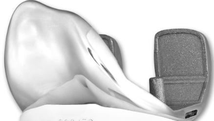 XM-PS C&oacute;ndilo femoral-1