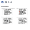 Sistema de cifoplastia (PKP/PVP): kit de cemento y globo para el cuerpo vertebral