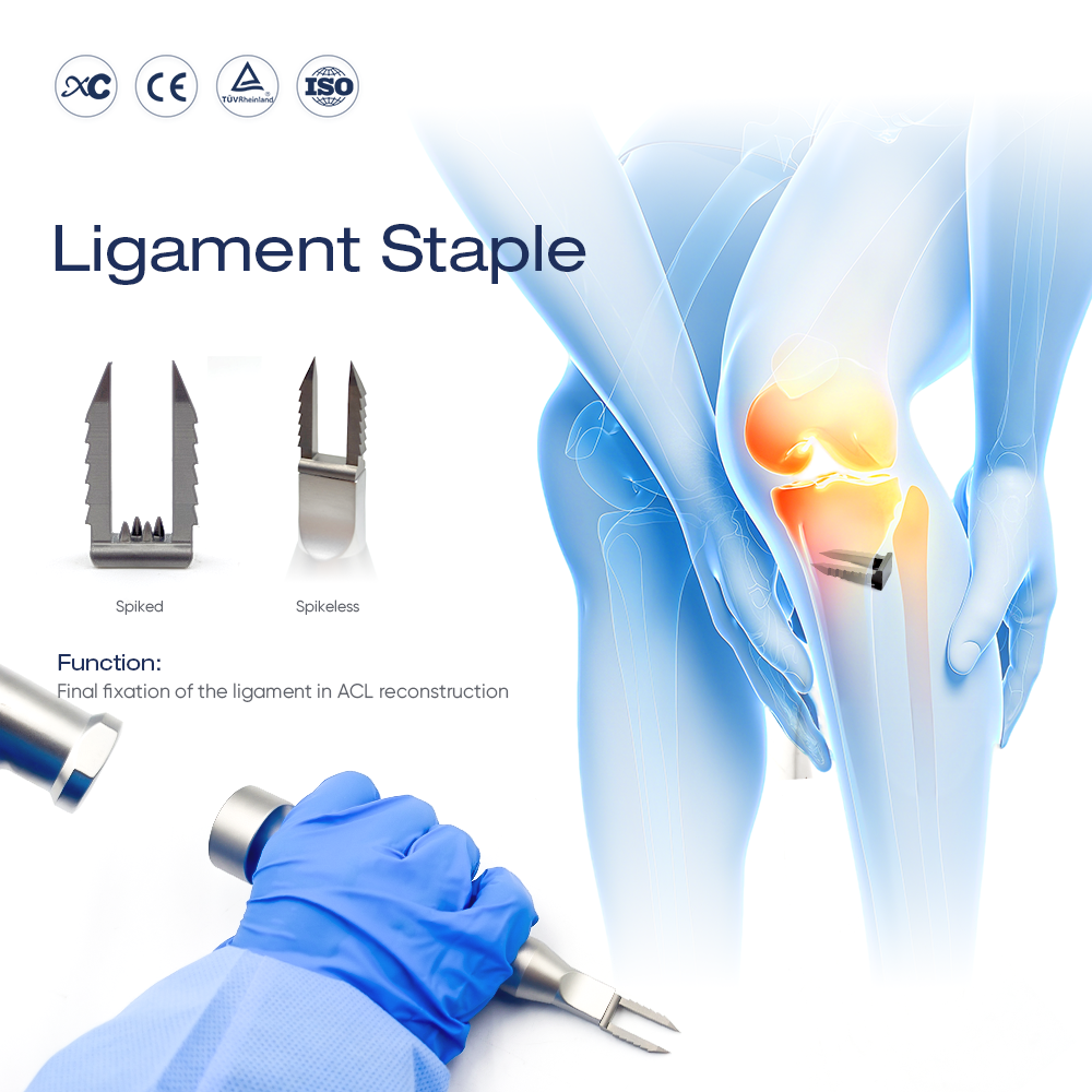 Grapa de ligamento | Fijaci&oacute;n de tejidos blandos para la reconstrucci&oacute;n del LCA | Grapa de ligamento de medicina deportiva XC Medico 