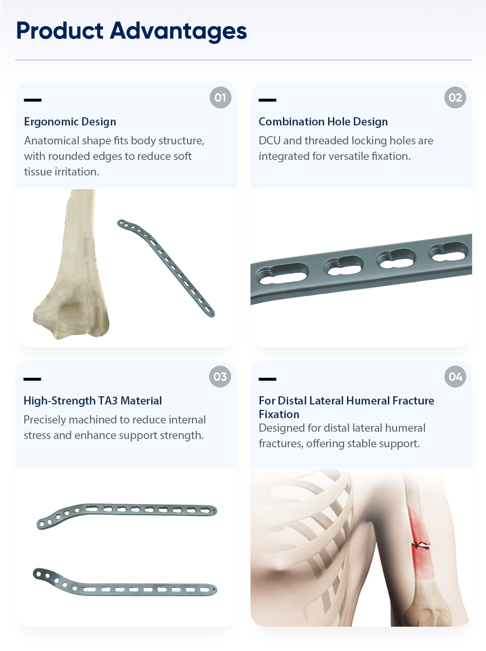 Caracter&iacute;sticas t&eacute;cnicas y configuraci&oacute;n de los tornillos de la placa de bloqueo para el h&uacute;mero distal