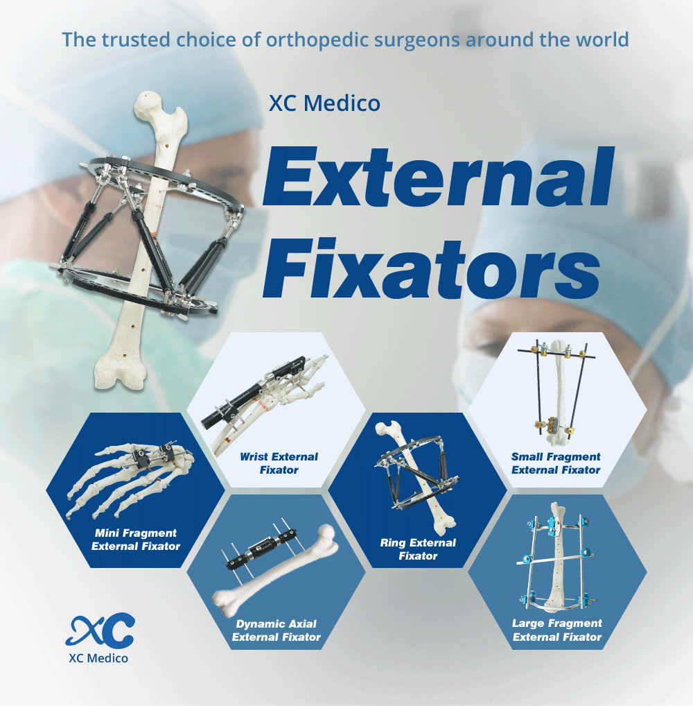 Sistema de fijaci&oacute;n externa de f&eacute;mur y tibia.