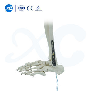 Placa de bloqueo tibioperoneo distal-III