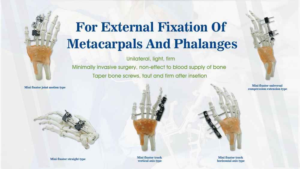 Fijaci&oacute;n externa de metacarpianos y falanges - Imagen 2 