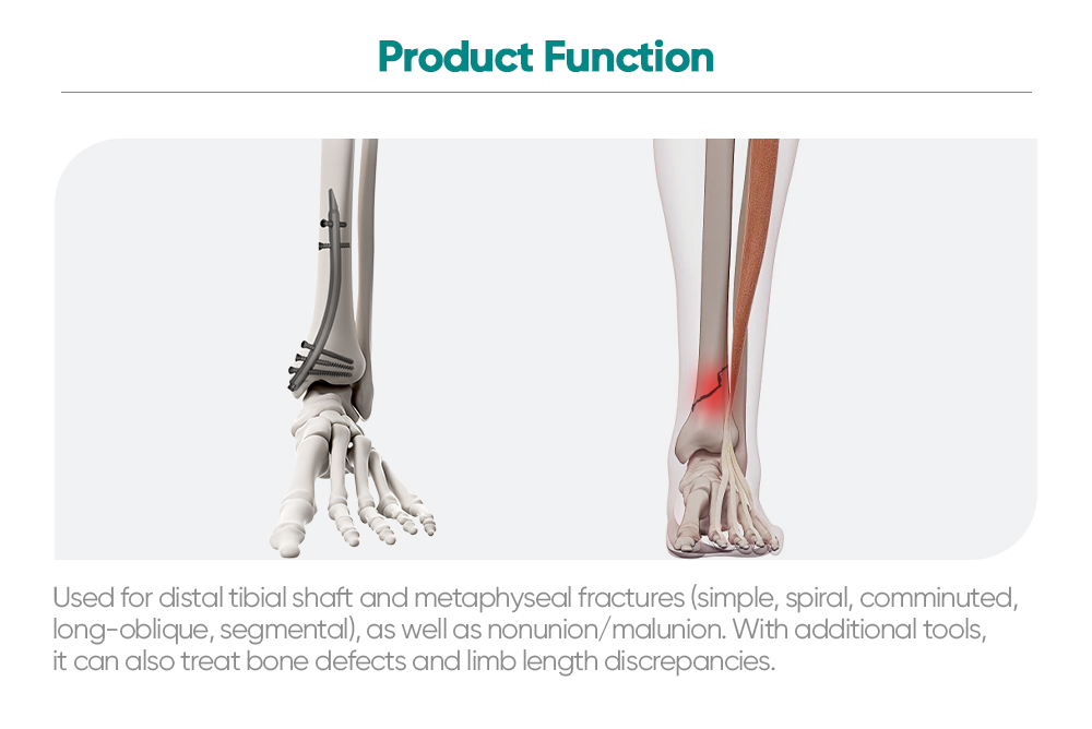 Juego de instrumentos para clavo tibial retr&oacute;grado Kit de fijaci&oacute;n de fracturas de tibia distal | XC Medico | 