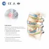 Conjunto de instrumentos de portal espinal MIS para cirugía de columna mínimamente invasiva
