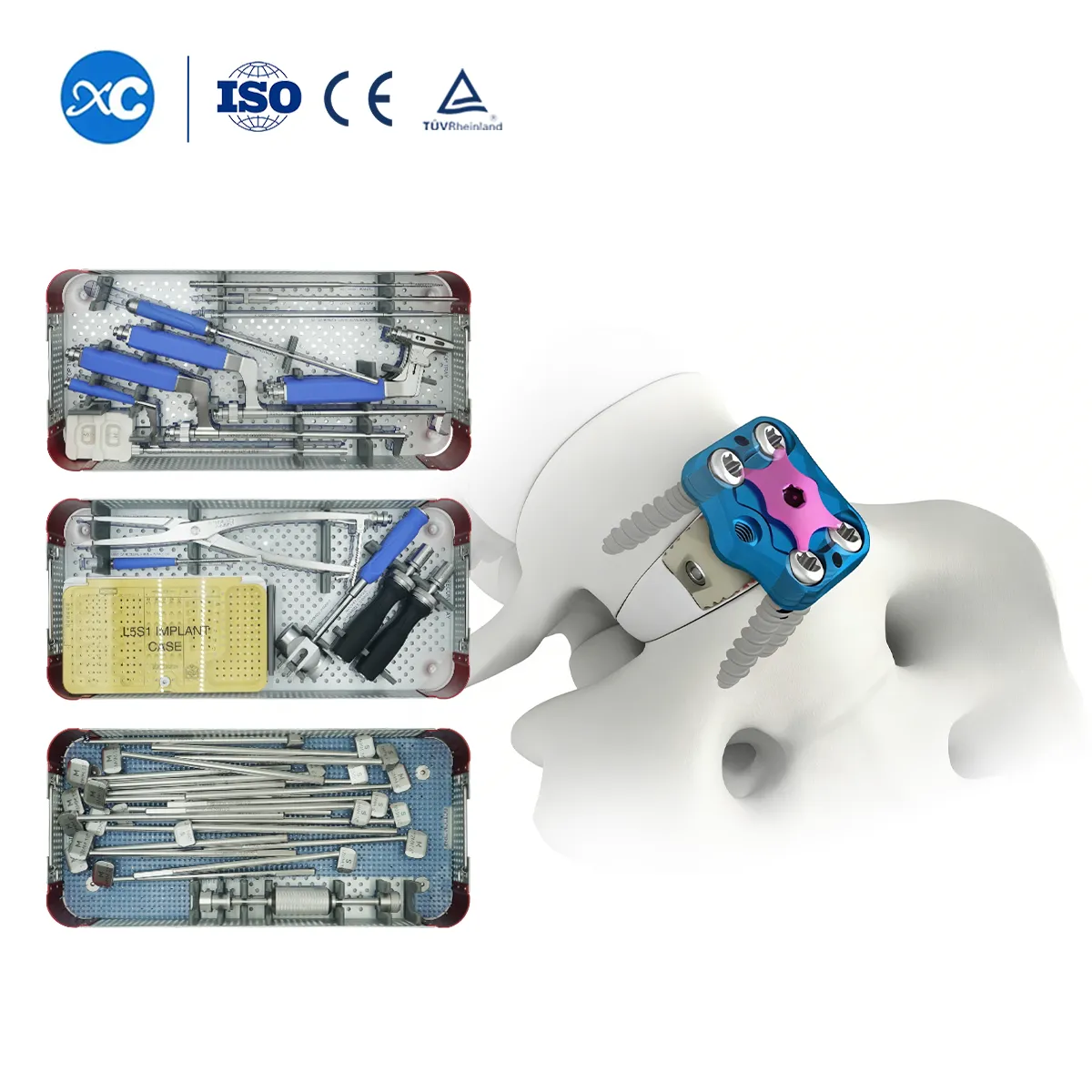 Conjunto de instrumentos del sistema de fijación de fusión anterior