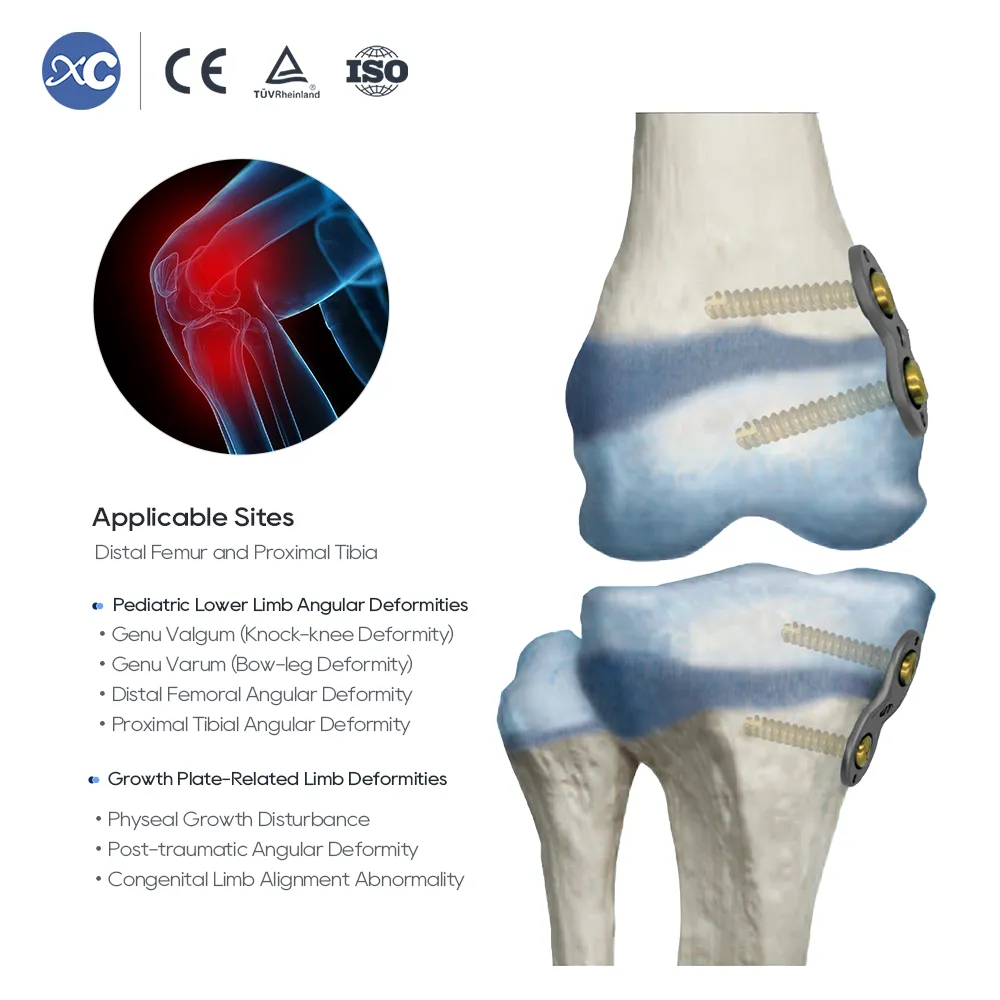 Conjunto de instrumentos ortopédicos pediátricos Valgus Varus