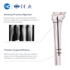 Clavo intramedular de tibia