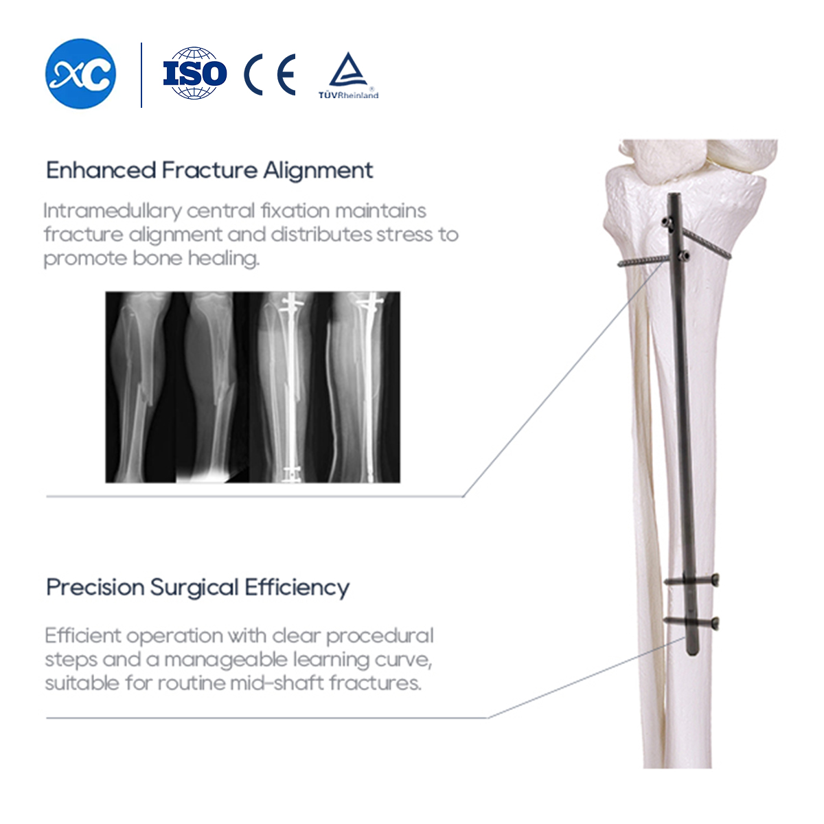 Juego de instrumentos para clavo intramedular tibial