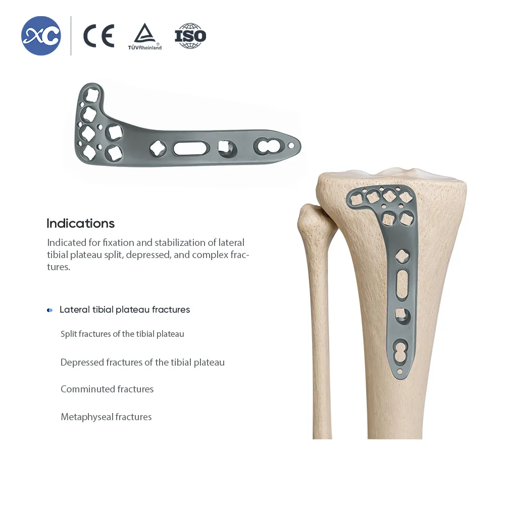 Placa de bloqueo de meseta tibial lateral multiaxial